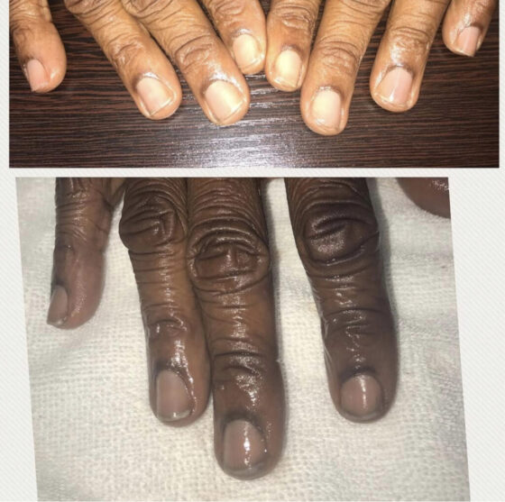 Manicures