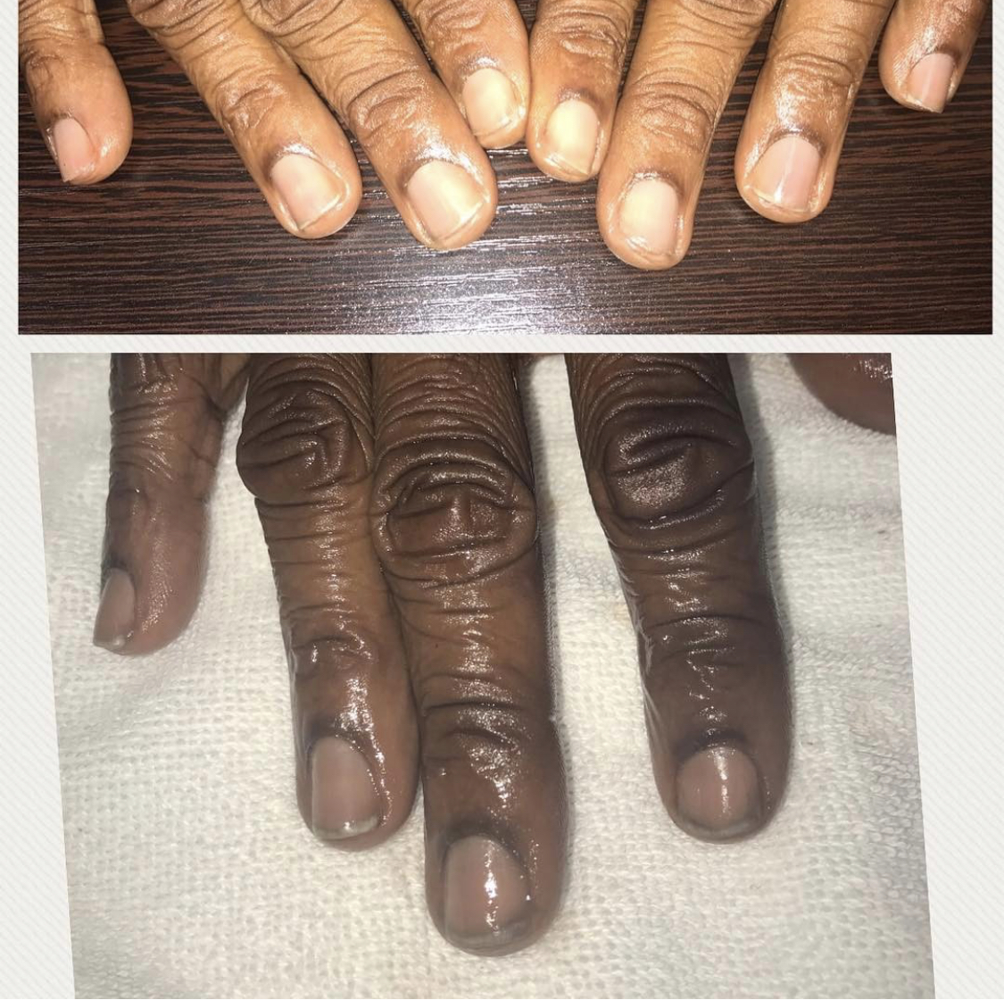 Manicure Before and After Manicure Before and After